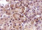 Phospho-4EBP1 (Thr36) Antibody in Immunohistochemistry (Paraffin) (IHC (P))