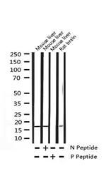 Phospho-4EBP1 (Thr36) Antibody in Western Blot (WB)