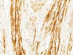 Phospho-CaMKII beta/gamma/delta (Thr287) Polyclonal Antibody