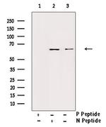 Phospho-IL10RA (Tyr496) Polyclonal Antibody