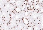 Phospho-SMC1 (Ser957) Polyclonal Antibody