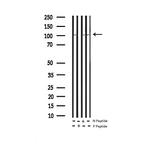 Phospho-PKD1/2/3/PKC mu (Ser738, Ser742) Antibody in Western Blot (WB)