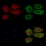 Phospho-IkappaB beta (Ser23) Polyclonal Antibody