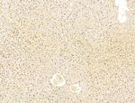 Phospho-SMAD2 (Ser467) Antibody in Immunohistochemistry (Paraffin) (IHC (P))