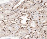 Phospho-p38 MAPK alpha (Tyr182) Polyclonal Antibody