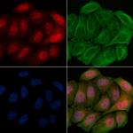 Phospho-CAMKIV (Thr200) Polyclonal Antibody