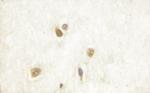Phospho-CAMKIV (Thr200) Antibody in Immunohistochemistry (Paraffin) (IHC (P))