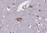 Phospho-TRKB (Tyr706) Antibody in Immunohistochemistry (Paraffin) (IHC (P))