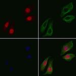 Phospho-PDCD4 (Ser67) Polyclonal Antibody