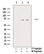 Phospho-FRS2 (Tyr436) Antibody in Western Blot (WB)