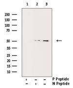 Phospho-BLNK (Tyr96) Antibody in Western Blot (WB)