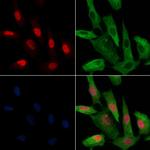 Phospho-HDAC2 (Ser394) Polyclonal Antibody