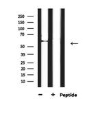 Phospho-HDAC2 (Ser394) Antibody in Western Blot (WB)