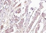 Phospho-BAD (Ser118) Antibody in Immunohistochemistry (Paraffin) (IHC (P))