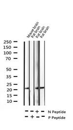 Phospho-CPI-17 (Thr38) Antibody in Western Blot (WB)
