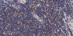 Phospho-ASK1 (Ser966) Polyclonal Antibody
