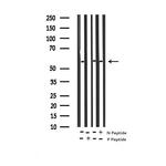 Phospho-DOK1 (Tyr362) Polyclonal Antibody