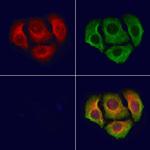 Phospho-DOK1 (Tyr398) Polyclonal Antibody