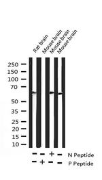 Phospho-DOK1 (Tyr398) Antibody in Western Blot (WB)