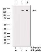 Phospho-FANCD2 (Ser222) Antibody in Western Blot (WB)