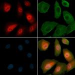 Phospho-HDAC8 (Ser39) Polyclonal Antibody