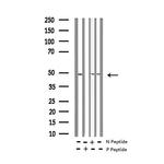 Phospho-HDAC8 (Ser39) Antibody in Western Blot (WB)
