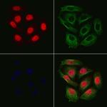 Phospho-RACGAP1 (Ser387) Polyclonal Antibody