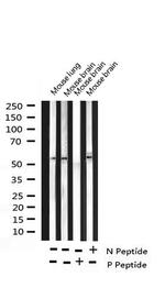 Phospho-RPS6KB2 (Ser423) Polyclonal Antibody