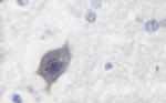 Phospho-ALK (Tyr1507) Polyclonal Antibody