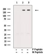Phospho-ALK (Tyr1507) Antibody in Western Blot (WB)