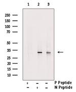 Phospho-SLUG (Ser104) Polyclonal Antibody