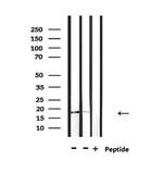 IL-1 beta (Cleaved Asp116) Polyclonal Antibody
