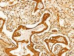 CASPASE 1 P10 (CLEAVED ALA317) Antibody in Immunohistochemistry (Paraffin) (IHC (P))