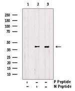 Phospho-CK1 alpha (Thr321) Polyclonal Antibody
