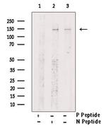 Phospho-SIN3A (Ser832) Polyclonal Antibody