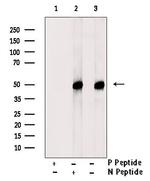 Phospho-DEPDC6 (Ser244) Polyclonal Antibody