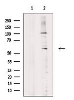 Phospho-PHGDH (Thr78) Polyclonal Antibody