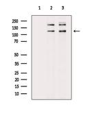 Phospho-53BP2 (Ser698) Polyclonal Antibody