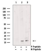 Phospho-ROC1 (Thr9) Polyclonal Antibody