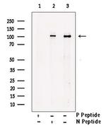 Phospho-ITCH / AIP4 (Tyr420) Polyclonal Antibody