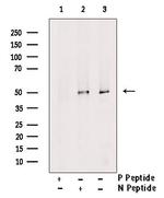 Phospho-PPAR delta (Thr256) Polyclonal Antibody