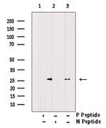 Phospho-PPP1R8 (Ser199) Polyclonal Antibody