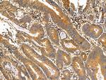 Phospho-NEDD4 (Ser670) Polyclonal Antibody