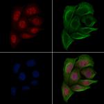 Phospho-PABPN1 (Ser150) Polyclonal Antibody