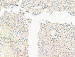Phospho-KSR2 (Thr497) Antibody in Immunohistochemistry (Paraffin) (IHC (P))