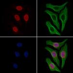 Phospho-NCF2 (Thr223) Polyclonal Antibody