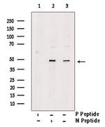 Phospho-PAR1 (Tyr420) Polyclonal Antibody
