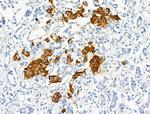 Phospho-CD79b (Tyr207) Antibody in Immunohistochemistry (Paraffin) (IHC (P))