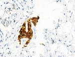 Phospho-CD79b (Tyr207) Antibody in Immunohistochemistry (Paraffin) (IHC (P))