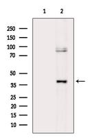 Phospho-CD79b (Tyr207) Antibody in Western Blot (WB)